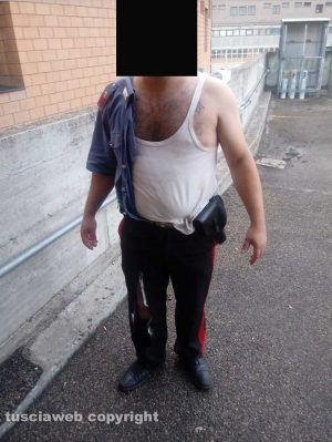 Orte – Uno dei carabinieri aggrediti