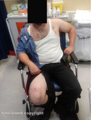 Orte – Uno dei carabinieri aggrediti