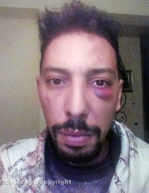 Jaouad Ouboulmane dopo il pestaggio