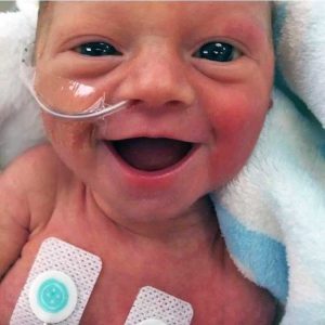 Il sorriso della bimba nata prematura