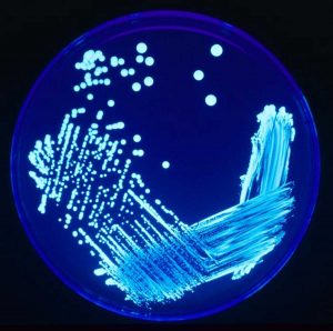 Il batterio della Legionella