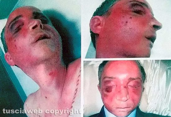 Viterbo - Omicidio del Suffragio - Daniele Barchi col volto tumefatto