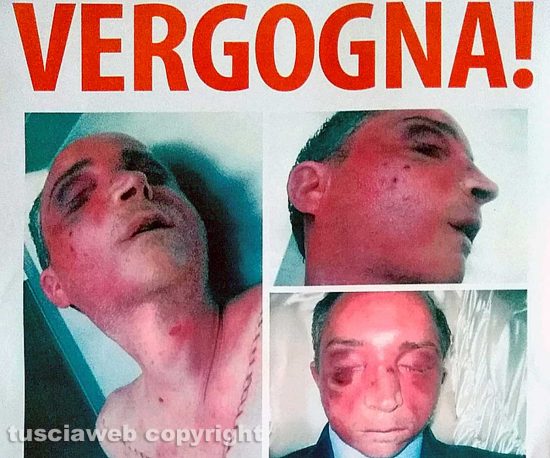 Viterbo - Omicidio del Suffragio - Daniele Barchi col volto tumefatto