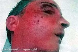 Viterbo - Omicidio del Suffragio - Daniele Barchi col volto tumefatto