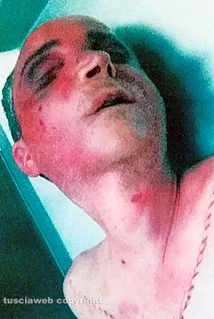 Viterbo - Omicidio del Suffragio - Daniele Barchi col volto tumefatto