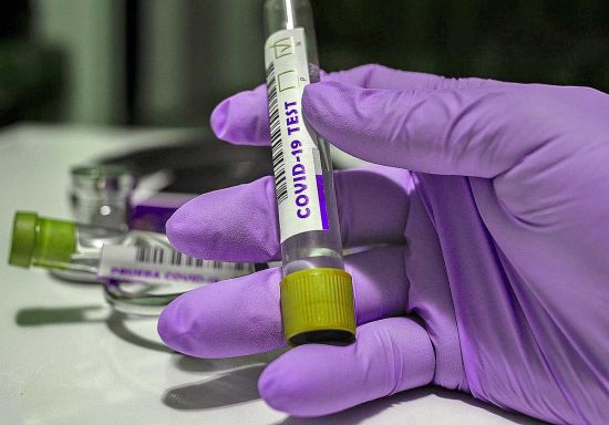 Virus - Laboratorio