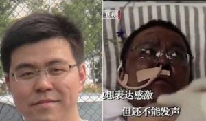 Wuhan - Medico cinese che ha contratto il Covid-19 e si è risvegliato con la pigmentazione alterata