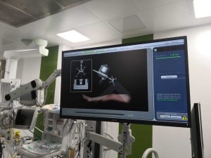 Il nuovo macchinario al Cto