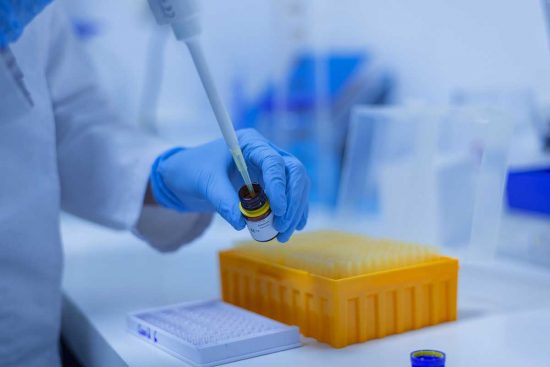 Coronavirus - Laboratorio