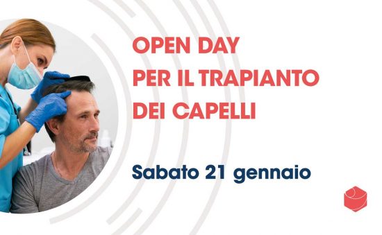 Viterbo - Centro medico Santa Rosa - Open day per il trapianto dei capelli