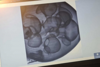 Viterbo - Le anfore al Museo Rocca Albornoz