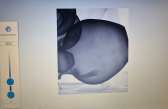 Viterbo - Le anfore al Museo Rocca Albornoz