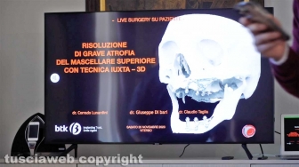 Viterbo - L’intervento realizzato da Claudio Taglia