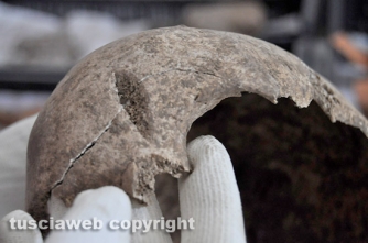 Strage a Ferento - Cranio colpito da ascia