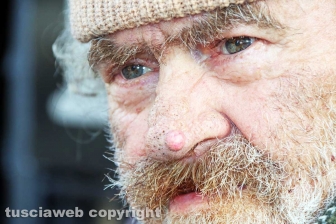 Vivere tra monnezza, topi e scarafaggi