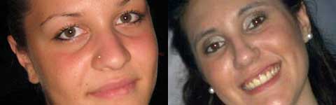 Valentina Floriani e Martina Saletti