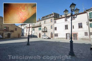Graffignano e nel riquadro la mano della donna, sfregiata con una sostanza corrosiva
