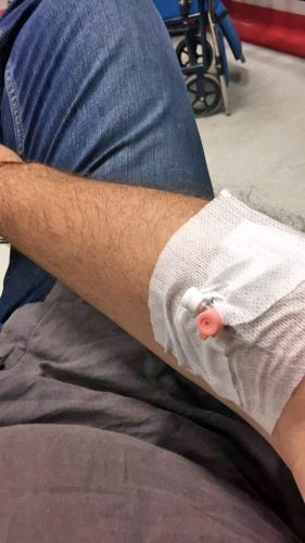 Filippo Rossi al pronto Soccorso 
