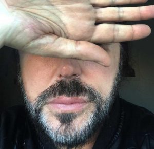 Scialpi