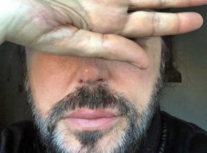 Scialpi