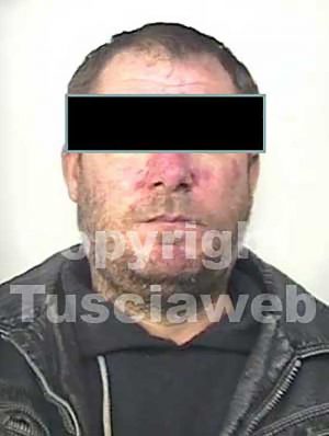 Viterbo - Aggressione e rapina al Bullicame - L'arrestato M.M