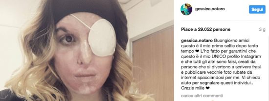 Il selfie di Gessica Notaro