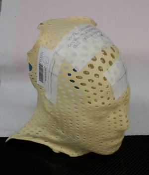 Tipica maschera utilizzata durante la terapia