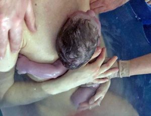 Viterbo - Primo parto in acqua a Belcolle