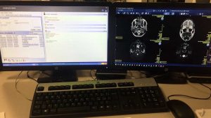 Asl - Uno dei nuovi metodi informatici