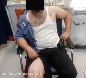 Orte – Uno dei carabinieri aggrediti