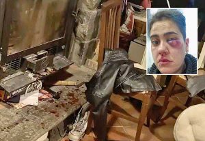 Bolsena - La casa messa a soqquadro con sangue dappertutto - Nel riquadro Stefania Calendo dopo il pestaggio