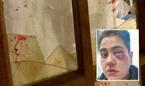 Bolsena - La finestra distrutta e nel riquadro Stefania Calendo dopo il pestaggio