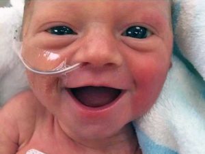 Il sorriso della bimba nata prematura