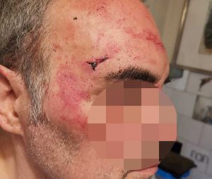 L'uomo aggredito a Torino