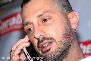 Viterbo - Fabrizio Corona da Carabetta