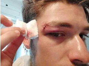 Roma - L'aggressione ai quattro ragazzi