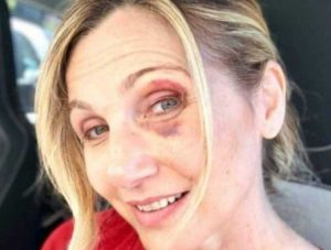 Lorella Cuccarini dopo l'incidente