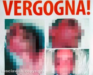 Viterbo - Omicidio del Suffragio - Daniele Barchi col volto tumefatto