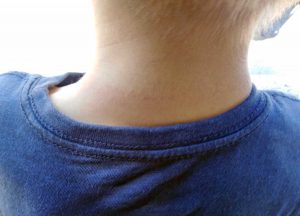 Viterbo - Bambino rischia di rimanere impiccato con la cintura di sicurezza