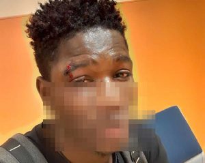 Il giovane aggredito a Palermo
