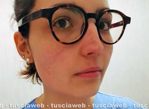 Alessia Ferri - Sul volto dell'infermiera i segni delle protezione da Coronavirus