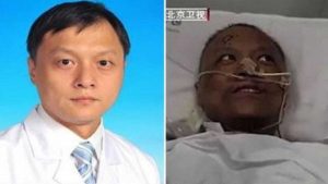 Wuhan - Medico cinese che ha contratto il Covid-19 e si è risvegliato con la pigmentazione alterata