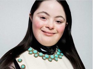Ellie Goldstein