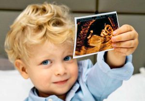 Chiara Ferragni incinta - Il primogenito Leone mostra l'ecografia