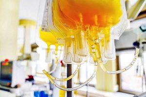 Plasma iperimmune