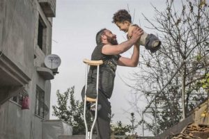 Mustafa, il bambino siriano nato senza arti, e suo padre