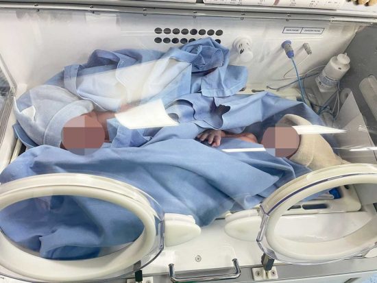 Civitavecchia - I gemellini nati con parto spontaneo all'ospedale San Paolo