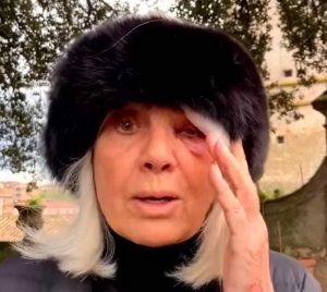 La principessa Claudia Ruspoli scivola sul brecciolino e si fa un occhio nero