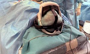Viterbo - Paziente sveglio operato con la realtà virtuale al santa Rosa