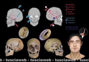Tarquinia - Etruschi - Rappresentazione schematica e fotografica del cranio dell'individuo 10 rinvenuto al ‘complesso monumentale’ della Civita di Tarquinia, che mostra le lesioni antemortem e perimortem e la ricostruzione facciale 